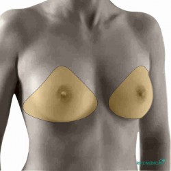 Prothèse mammaire externe Natura 2A Comfort+ par Amoena - Superposition sur le corps