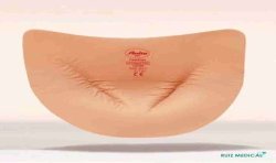Prothèse mammaire externe TwinFlex Asymmetric 1073X par Anita - Face interne