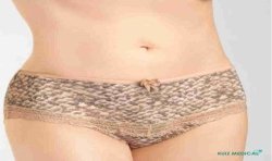 Panty Lucy par Amoena - Vue de face