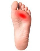 Chaussures médicales en cas de Métatarsalgie